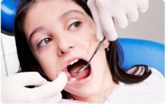 拔牙的誤區有哪些